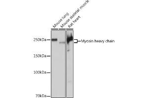Western blot analysis of extracts of various cell lines, using Myosin heavy chain Rabbit mAb (ABIN7268750) at 1:5000 dilution.