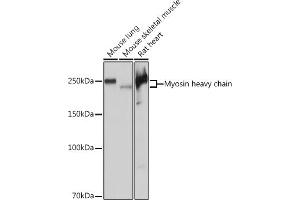 Western blot analysis of extracts of various cell lines, using Myosin heavy chain Rabbit mAb (ABIN7268750) at 1:5000 dilution. (MYH7 anticorps)