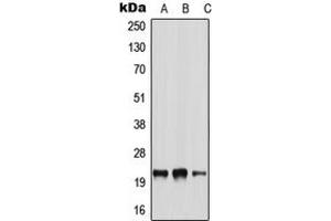 Western blot analysis of NRSN2 expression in A549 (A), NIH3T3 (B), H9C2 (C) whole cell lysates. (NRSN2 anticorps  (Center))