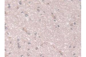 Detection of CXADR in Human Cerebrum Tissue using Polyclonal Antibody to Coxsackie Virus And Adenovirus Receptor (CXADR)