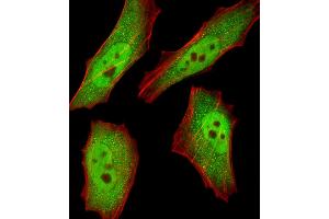 Fluorescent image of HeLa cells stained with RBX1 Antibody . (RBX1 anticorps  (C-Term))