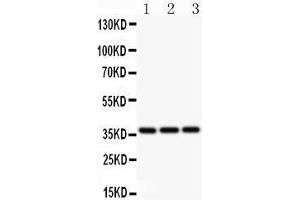 Anti-Bmi1 Picoband antibody,  All lanes: Anti BMI1  at 0. (BMI1 anticorps  (Middle Region))