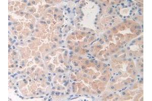 IHC-P analysis of Human Kidney Tissue, with DAB staining. (DOK3 anticorps  (AA 128-385))