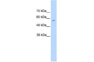 WB Suggested Anti-DDC Antibody Titration:  5. (DDC anticorps  (N-Term))