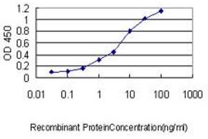 Detection limit for recombinant GST tagged PSPH is approximately 0. (PSPH anticorps  (AA 1-225))