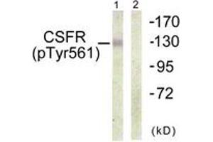 Western blot analysis of extracts from HepG2 cells, using CSFR (Phospho-Tyr561) Antibody. (CSF1R anticorps  (pTyr561))