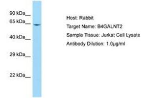 Image no. 1 for anti-beta-1,4-N-Acetyl-Galactosaminyl Transferase 2 (B4GALNT2) (AA 126-175) antibody (ABIN6750087) (B4GALNT2 anticorps  (AA 126-175))