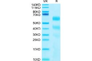 Human KIR3DL2 on Tris-Bis PAGE under reduced conditions.