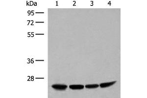 Western blot analysis of Human fetal liver tissue HepG2 K562 and Raji cell lysates using DTYMK Polyclonal Antibody at dilution of 1:400 (DTYMK anticorps)