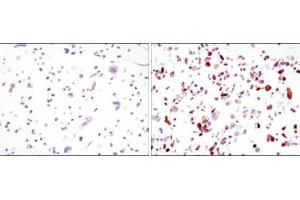 Immunocytochemistry analysis of HCC827 cells, untransfected (left) or transfected with GFP (right) using GFP antibody . (GFP anticorps)