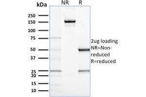 SDS-PAGE Analysis Purified CD68 Mouse Monoclonal Antibody (C68/684).