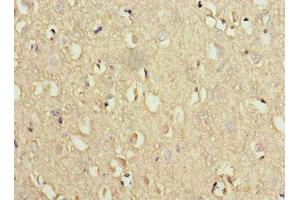 Immunohistochemistry of paraffin-embedded human brain tissue using ABIN7175774 at dilution of 1:100 (WDR6 anticorps  (AA 1-200))