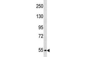 PCSK4 antibody western blot analysis in SK-BR-3 lysate.
