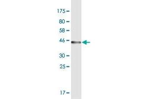 Western Blot detection against Immunogen (43. (ODAM anticorps  (AA 1-153))