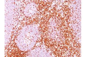 Formalin-fixed, paraffin-embedded human Tonsil stained with CD6 Mouse Monoclonal Antibody (C6/372). (CD6 anticorps)