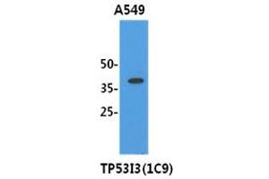 Image no. 1 for anti-Tumor Protein P53 Inducible Protein 3 (TP53I3) antibody (ABIN1490748)