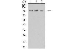 Western blot analysis using KDM1A mouse mAb against K562 (1), Jurkat (2), and Hela (3) cell lysate.