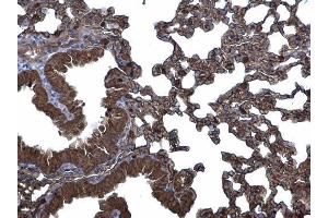 IHC-P Image CLIC3 antibody [N1C3] detects CLIC3 protein at membrane and cytoplasm on mouse lung by immunohistochemical analysis.