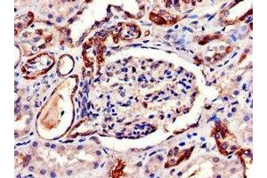 Immunohistochemistry of paraffin-embedded human kidney tissue using ABIN7144520 at dilution of 1:100 (AQP6 anticorps  (AA 1-30))