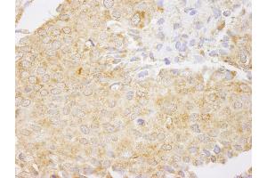 Immunohistochemistry (IHC) image for anti-Nuclear Factor of kappa Light Polypeptide Gene Enhancer in B-Cells 1 (NFKB1) (AA 918-968) antibody (ABIN7448689)