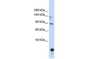 WB Suggested Anti-TULP4 Antibody Titration:  0. (TULP4 anticorps  (N-Term))