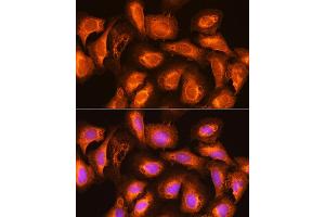 Immunofluorescence analysis of U2OS cells using SEC11A Rabbit pAb (ABIN6133117, ABIN6147478, ABIN6147479 and ABIN6214843) at dilution of 1:100.