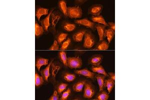 Immunofluorescence analysis of U2OS cells using SEC11A Rabbit pAb (ABIN6133117, ABIN6147478, ABIN6147479 and ABIN6214843) at dilution of 1:100. (SEC11A anticorps  (AA 37-145))