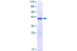 Image no. 1 for Peroxiredoxin 5 (PRDX5) (AA 1-214) protein (GST tag) (ABIN1316159)