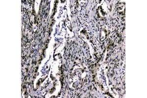 IHC testing of FFPE rat testis tissue with UBA2 antibody at 1ug/ml. (UBA2 anticorps)