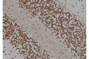 ABIN6277385 at 1/100 staining Rat brain tissue by IHC-P.