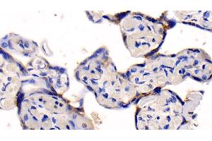 Detection of NFkB in Human Placenta Tissue using Polyclonal Antibody to Nuclear Factor Kappa B (NFkB)