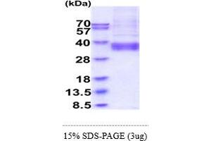 SDS-PAGE (SDS) image for ADP-Ribosyltransferase 4 (Dombrock Blood Group) (ART4) (AA 47-285) protein (His tag) (ABIN6388163)