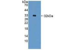 Western blot analysis of recombinant Human ADAM33. (ADAM33 anticorps  (AA 210-503))