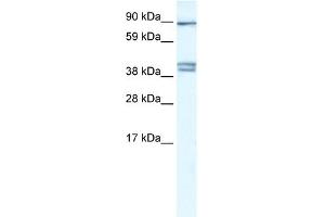 WB Suggested Anti-CLCNKB Antibody Titration:  0. (CLCNKB anticorps  (C-Term))