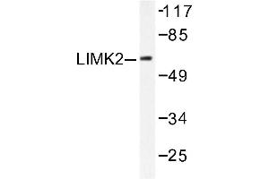 Image no. 1 for anti-LIM Domain Kinase 2 (LIMK2) antibody (ABIN265509) (LIMK2 anticorps)