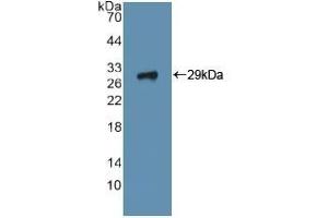 Detection of Recombinant ITGa2, Human using Polyclonal Antibody to Integrin Alpha 2 (ITGa2) (ITGA2 anticorps  (AA 170-361))