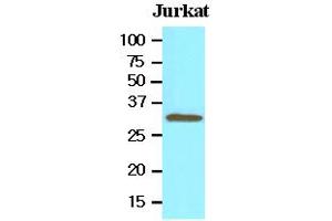 Western Blotting (WB) image for anti-Toll Interacting Protein (TOLLIP) (AA 61-274) antibody (ABIN336082)