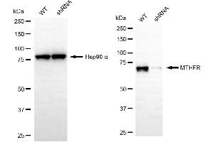 Western blotting analysis using MTHFR antibody (ABIN7799391).