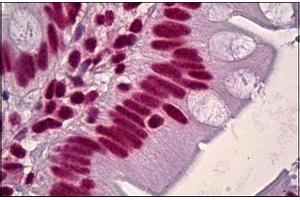 Human Small Intestine: Formalin-Fixed, Paraffin-Embedded (FFPE) (HNRNPD/AUF1 anticorps)