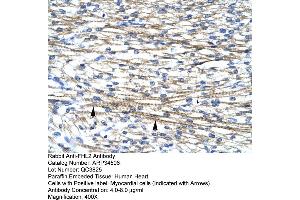 anti-Four and A Half LIM Domains 2 (FHL2) (C-Term) antibody
