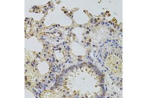 Immunohistochemistry of paraffin-embedded rat lung using PLK4 antibody. (PLK4 anticorps)