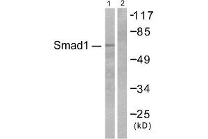 Western Blotting (WB) image for anti-SMAD, Mothers Against DPP Homolog 1 (SMAD1) (Ser465) antibody (ABIN1847896)