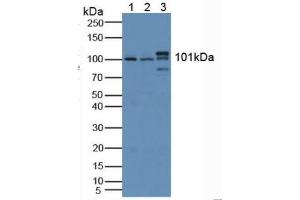 Rabbit Detection antibody from the kit in WB with Positive Control: Sample Lane1: Human Lung Tissue; Lane2: Mouse Lung Tissue; Lane3: Mouse Brain Tissue.