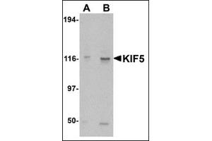 Western blot analysis of KIF5 in K562 cell lysate with this product at (A) 0. (KIF5A anticorps  (C-Term))