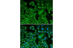 Immunofluorescence (IF) image for anti-ARP3 Actin-Related Protein 3 (ACTR3) (AA 1-418) antibody (ABIN6214919) (ACTR3 anticorps  (AA 1-418))