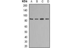 Western blot analysis of KAO expression in mouse liver (A), mouse heart (B), rat kidney (C), rat heart (D) whole cell lysates. (DAO anticorps)