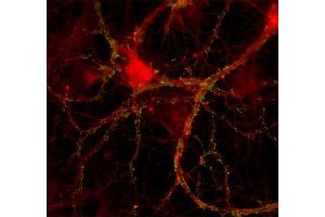 Indirect immunostaining of rat hippocampus neurons with anti-Mint 1 (dilution 1 : 200; red) and anti-synapsin (cat.