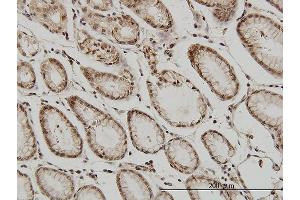 Immunoperoxidase of monoclonal antibody to ATF2 on formalin-fixed paraffin-embedded human stomach.