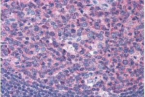 ABIN184967 (3. (SNX16 anticorps  (N-Term))