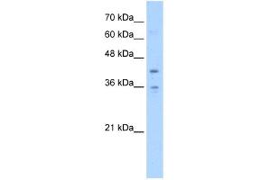 WB Suggested Anti-TMEM104 Antibody Titration:  5. (TMEM104 anticorps  (Middle Region))